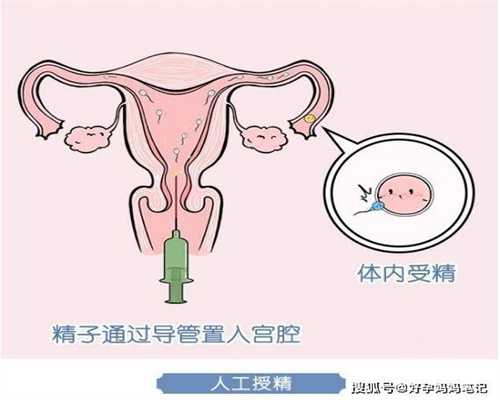 广州试管婴儿选男女多少钱_中国第三代试管的医院